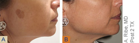 Slider image (9) Victor Regenerative Medicine Centers